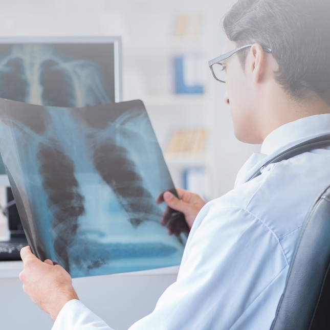 doctor looking at an x-ray of lungs